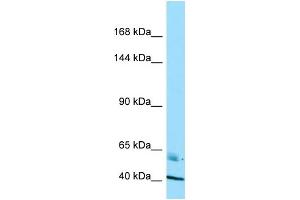 Western Blotting (WB) image for anti-Ras Association and DIL Domains (Radil) (C-Term) antibody (ABIN2789578) (Radil anticorps  (C-Term))