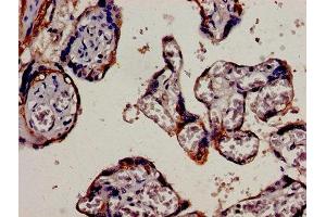 anti-Keratin 18 (KRT18) (AA 102-396) antibody