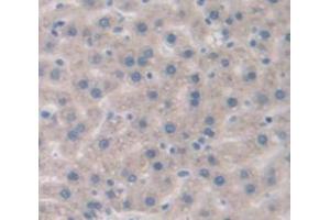 IHC-P analysis of Rat Tissue, with DAB staining. (IL-6 Receptor anticorps  (AA 214-348))