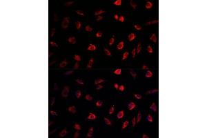 Immunofluorescence analysis of L929 cells using NEDD1 antibody (ABIN1681008, ABIN3019378, ABIN3019379 and ABIN6220853) at dilution of 1:100.