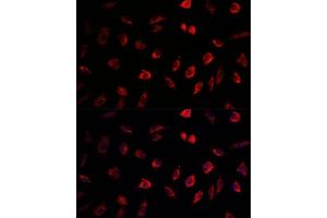 Immunofluorescence analysis of L929 cells using NEDD1 antibody (ABIN1681008, ABIN3019378, ABIN3019379 and ABIN6220853) at dilution of 1:100. (NEDD1 anticorps  (AA 411-660))