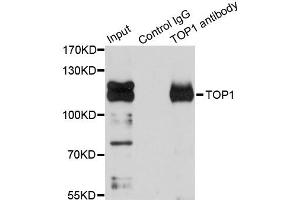Immunoprecipitation analysis of 150ug extracts of Jurkat cells using 3ug TOP1 antibody. (Topoisomerase I anticorps)