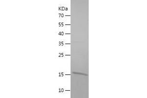 Western Blotting (WB) image for Single-Stranded DNA Binding Protein 1 (SSBP1) (AA 17-148) protein (His tag) (ABIN7125102)