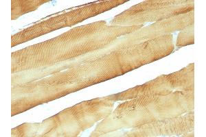 Formalin-fixed, paraffin-embedded Rat Skeletal Muscle stained with Muscle Specific Actin Mouse Monoclonal Antibody (MSA/953). (ACTA1/ACTA2A/ACTG2 anticorps)