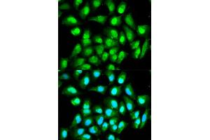 Immunofluorescence analysis of HeLa cells using RAN antibody. (RAN anticorps)