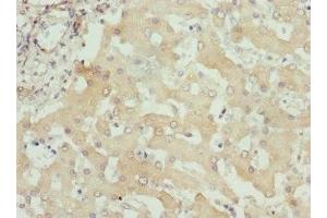 Immunohistochemistry of paraffin-embedded human liver tissue using ABIN7156320 at dilution of 1:100