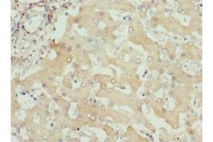 Immunohistochemistry of paraffin-embedded human liver tissue using ABIN7156320 at dilution of 1:100 (ITPK1 anticorps  (AA 185-414))