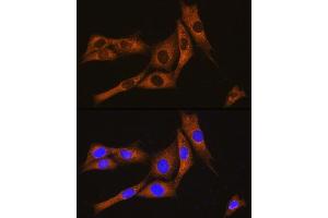 Immunofluorescence analysis of NIH/3T3 cells using GN Rabbit pAb (ABIN7267544) at dilution of 1:100.