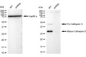 Western blotting analysis using Cathepsin D antibody (ABIN7797938).