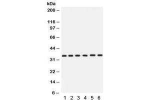 Western blot testing of 1) rat stomach, 2) rat thymus, 3) human HeLa, 4) A549, 5) SKOV and 6)  22RV1 with Cdk4 antibody.