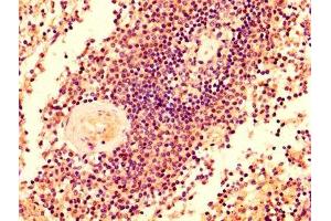 IHC image of ABIN7145433 diluted at 1:500 and staining in paraffin-embedded human spleen tissue performed on a Leica BondTM system. (GRK2 anticorps  (AA 2-221))