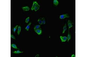 Immunofluorescent analysis of Hela cells using ABIN7156421 at dilution of 1:100 and Alexa Fluor 488-congugated AffiniPure Goat Anti-Rabbit IgG(H+L)