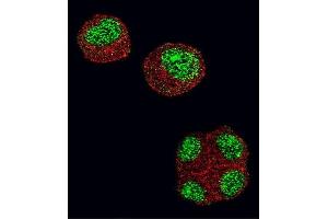 Confocal immunofluorescent analysis of HDAC1 Antibody (N-term) (ABIN1882087 and ABIN2844612) with 293 cell followed by Alexa Fluor 488-conjugated goat anti-rabbit lgG (green).