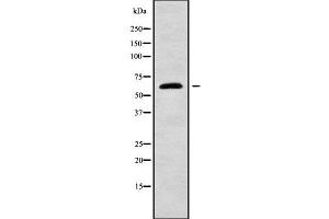 Western blot analysis GNL3 using LOVO whole cell lysates (Nucleostemin anticorps  (N-Term))