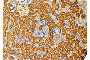 ABIN6261698 and ABIN6276856 at 1/100 staining Mouse kidney tissue by IHC-P. (Fc epsilon RI/FCER1A anticorps  (C-Term))