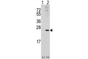 Western blot analysis of RAC1 antibody and 293 cell lysate (2 ug/lane) either nontransfected (Lane 1) or transiently transfected with the RAC1 gene (2).