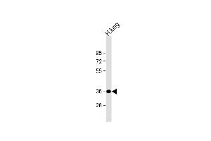 Anti-GRINA Antibody (Center) at 1:1000 dilution + human lung lysate Lysates/proteins at 20 μg per lane.