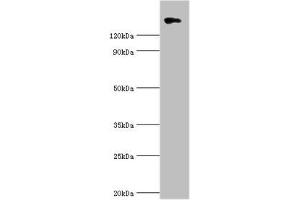 Western blot All lanes: Collagen alpha-1 (II) chain antibody at 10 μg/mL + 293T whole cell lysate Secondary Goat polyclonal to rabbit IgG at 1/10000 dilution Predicted band size: 142, 135, 30 kDa Observed band size: 142 kDa (COL2A1 anticorps  (AA 1228-1487))