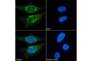Immunofluorescence staining of HeLa cells using anti-CD171. (Recombinant L1CAM anticorps)