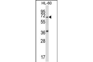 Western blot analysis in HL-60 cell line lysates (35ug/lane). (PKMYT1 anticorps  (N-Term))