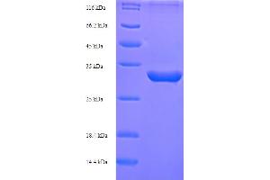 Inhibin, alpha (INHA) (AA 227-360) protein (His-SUMO Tag)