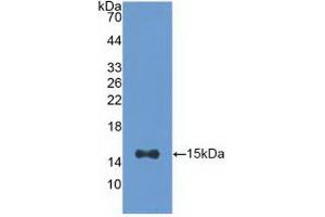 Western blot analysis of recombinant Human ACO1. (Aconitase 1 anticorps  (AA 458-586))