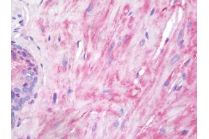 Human Prostate, Smooth Muscle: Formalin-Fixed, Paraffin-Embedded (FFPE) (Vinculin anticorps  (AA 356-607))