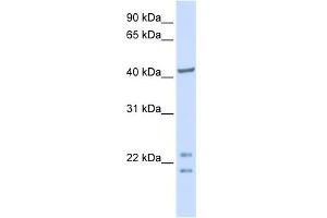 WB Suggested Anti-C16orf48 Antibody Titration:  0. (ENKD1 anticorps  (C-Term))