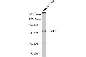 Western blot analysis of extracts of Mouse brain using GTF2I Polyclonal Antibody at dilution of 1:500. (GTF2I anticorps)