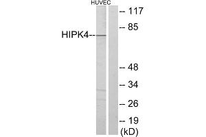 Western blot analysis of extracts from HUVEC cells, using HIPK4 antibody.