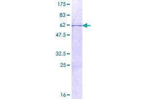 Image no. 1 for T-Cell Leukemia Homeobox 3 (TLX3) (AA 1-291) protein (GST tag) (ABIN1322892)