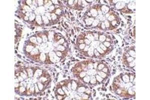 Immunohistochemistry (IHC) image for anti-CD248 Molecule, Endosialin (CD248) (C-Term) antibody (ABIN1030727)