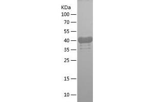 Western Blotting (WB) image for Hyaluronan-Mediated Motility Receptor (RHAMM) (HMMR) (AA 1-300) protein (His tag) (ABIN7123372)