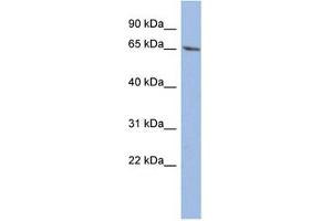 anti-Wilms Tumor 1 (WT1) (C-Term) antibody