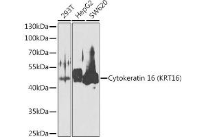 Western blot analysis of extracts of various cell lines, using Cytokeratin 16 (KRT16) antibody (ABIN6129541, ABIN6143021, ABIN6143022 and ABIN6223391) at 1:1000 dilution. (KRT16 anticorps  (AA 190-430))