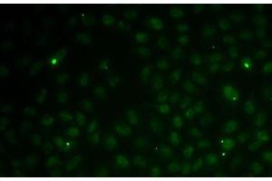 Immunofluorescence analysis of MCF7 cells using RAD51C Polyclonal Antibody (RAD51C anticorps)