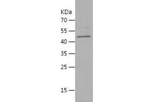 Western Blotting (WB) image for Acetylcholine Receptor Subunit alpha (CHRNA1) (AA 21-230) protein (His-IF2DI Tag) (ABIN7121647)