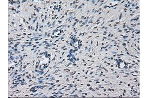 Immunohistochemical staining of paraffin-embedded liver tissue using anti-PRLmouse monoclonal antibody. (Prolactin anticorps)