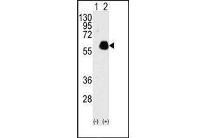 Western blot analysis of Paxillin (arrow) using rabbit polyclonal Paxillin Antibody. (Paxillin anticorps  (pTyr118))