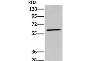Western blot analysis of Human fetal brain tissue lysate using GPC5 Polyclonal Antibody at dilution of 1:450 (GPC5 anticorps)