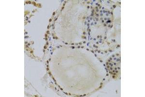 Immunohistochemistry of paraffin-embedded human thyroid using HDGF Antibody. (HDGF anticorps  (AA 1-240))