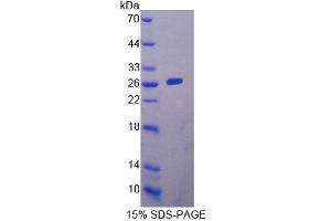 SDS-PAGE analysis of Mouse YAF2 Protein. (YAF2 Protéine)