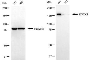 Western blotting analysis using ROCK1 antibody (ABIN7800202). (Recombinant ROCK1 anticorps)