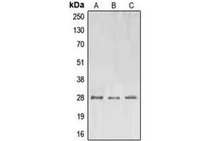 Western blot analysis of EPO expression in A549 (A), SP2/0 (B), PC12 (C) whole cell lysates. (EPO anticorps  (Center))