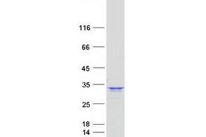 Validation with Western Blot