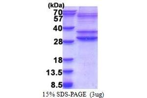 PMF1-BGLAP Readthrough (PMF1-BGLAP) (AA 1-211) protein (His tag)