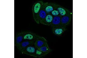 Immunofluorescence analysis of MCF-7 cells using CTNNBL1 mouse mAb (green).