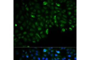 Immunofluorescence analysis of U2OS cells using HK2 Polyclonal Antibody (Hexokinase 2 anticorps)