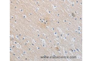 Immunohistochemistry of Human brain  using SLC16A7 Polyclonal Antibody at dilution of 1:30 (SLC16A7 anticorps)