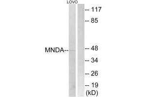 Western blot analysis of extracts from LOVO cells, using MNDA antibody. (MNDA anticorps  (C-Term))